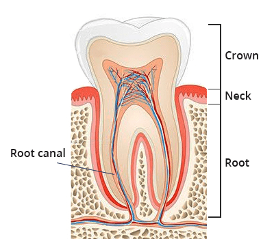 Root Canal Treatment